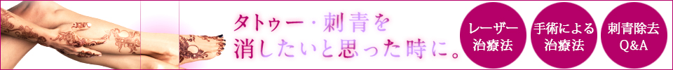 タトゥー・刺青を消したいと思った時に