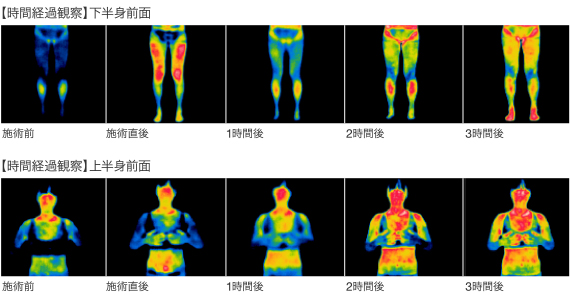 インディバの深部加温による体の温まりの検証